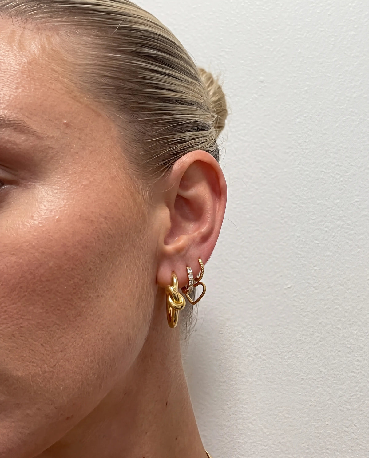 ARETE NUDO