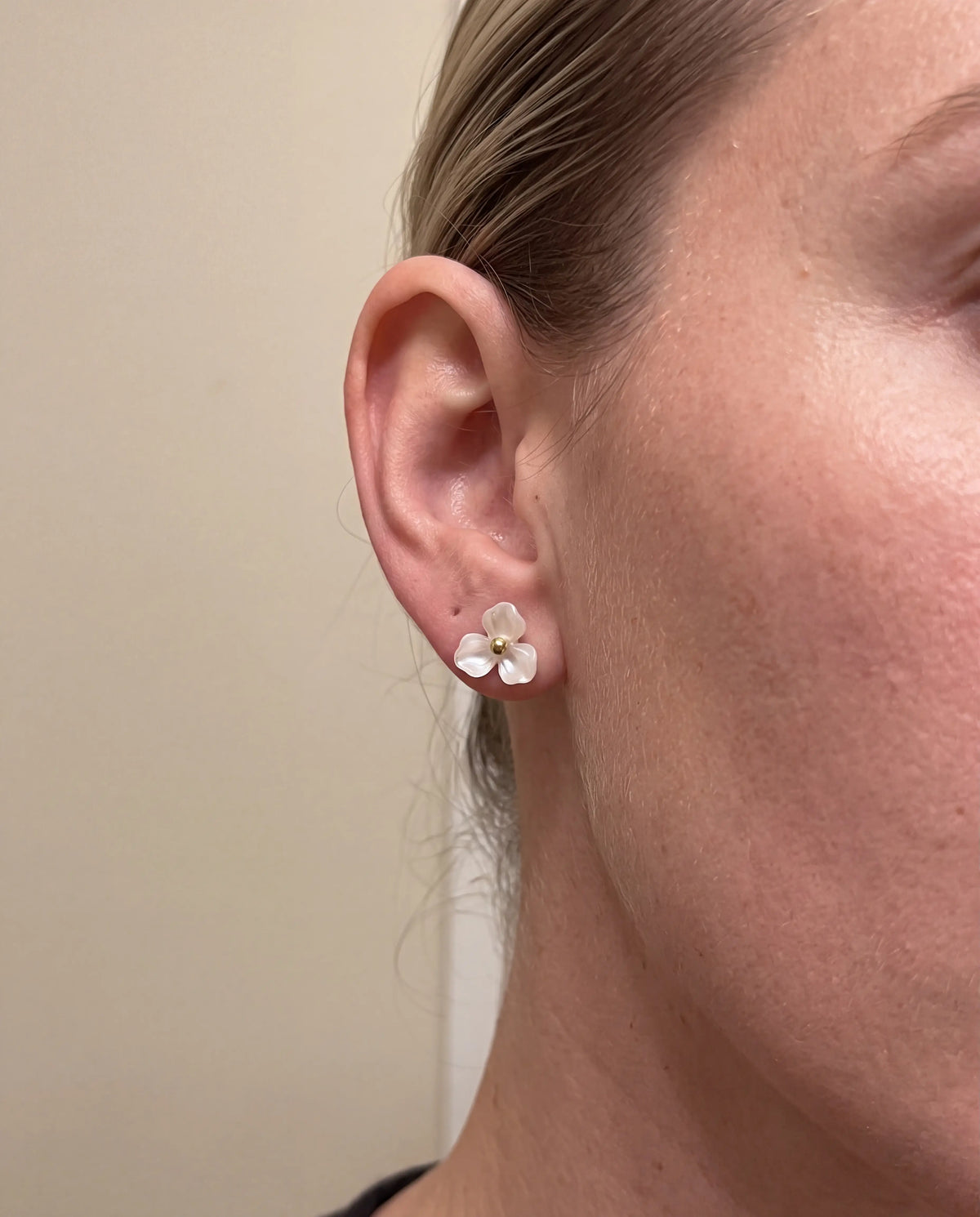 ARETES ALOHA